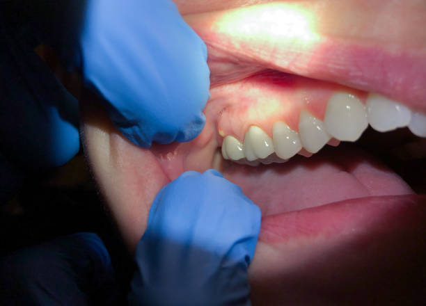 Best After-Hours Dental Care in Killen, AL